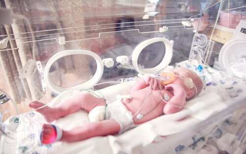 Baby in einem Inkubator an Schläuchen.