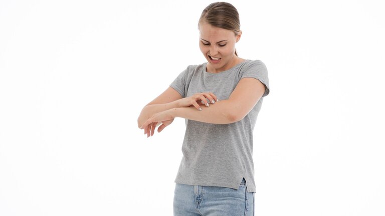 eine Frau, die sich den Arm kratzt | © pixabay