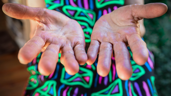 Frau zeigt ihre Hände | © Claudia van Zyl/unsplash