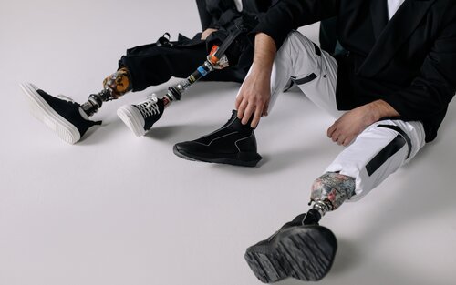 Auf dem Bild sind zwei sitzenden Menschen abgebildet, die schwarz-weiße, legere Kleidung und lässige Schuhe tragen. Die Beine der beiden sind durch Beinprothesen ersetzt. | © Pexels.com